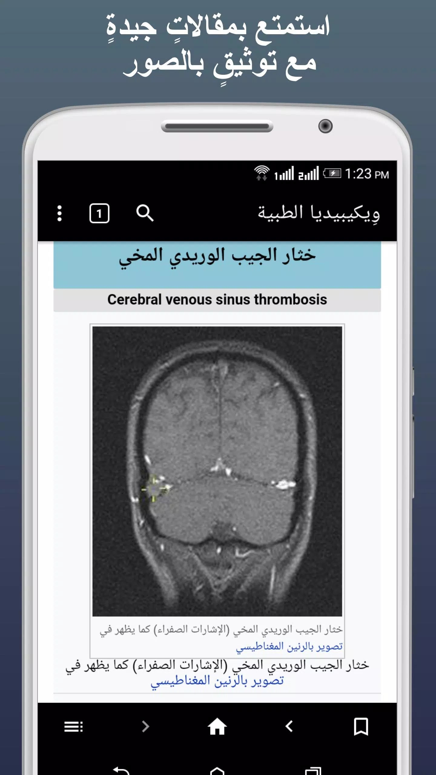 ويكيبيديا الطبية应用截图第2张